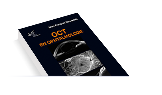 Rapport 2019 "OCT en ophtalmologie"