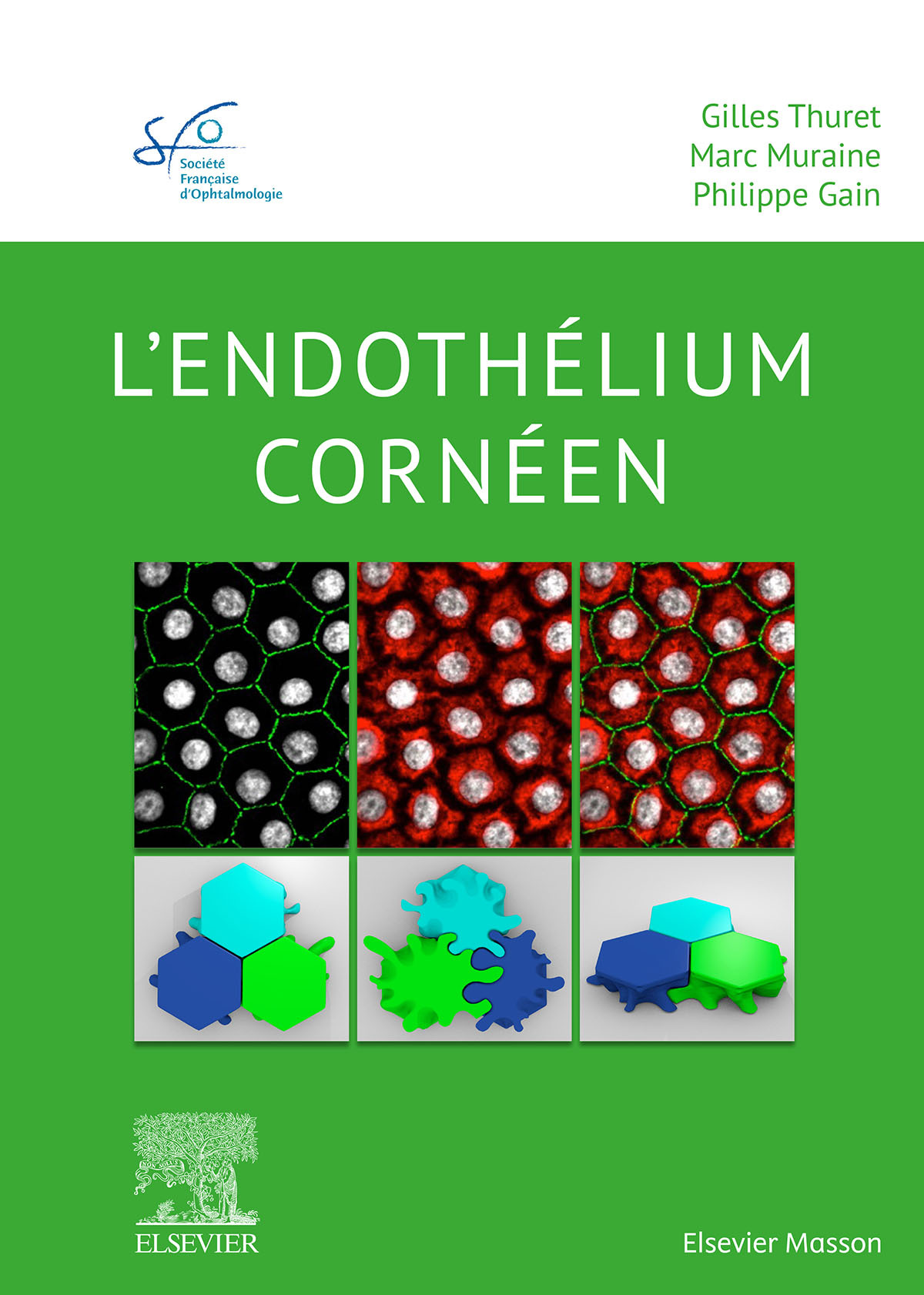 Rapport SFO, l'Endothélium cornéen