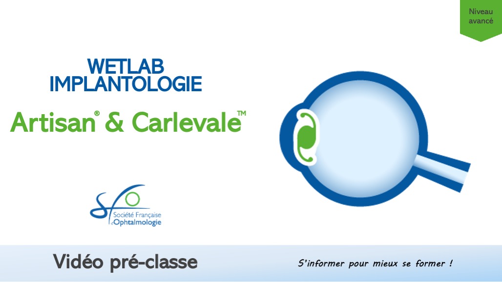 Implant Carlevale