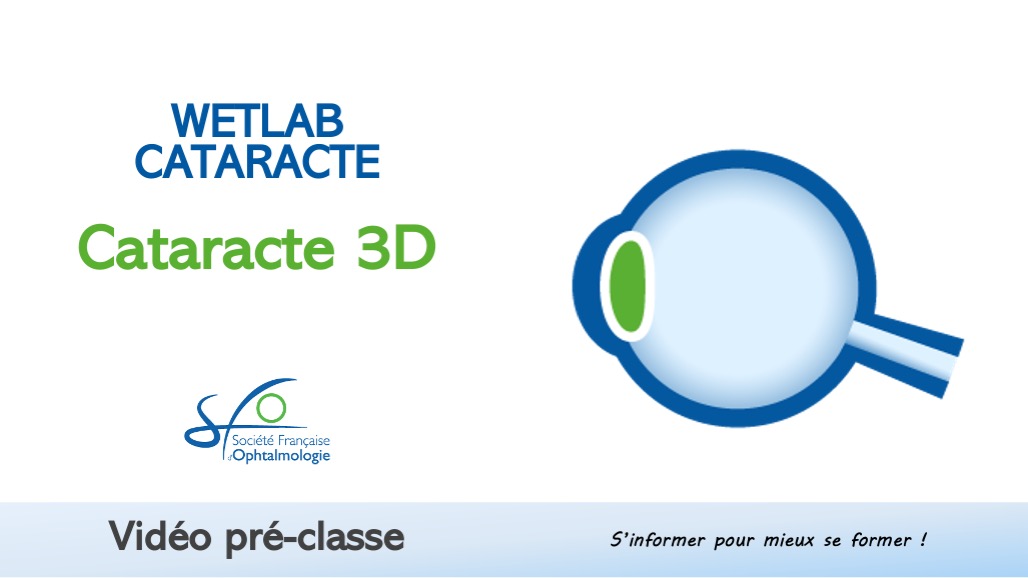 Cataracte 3D