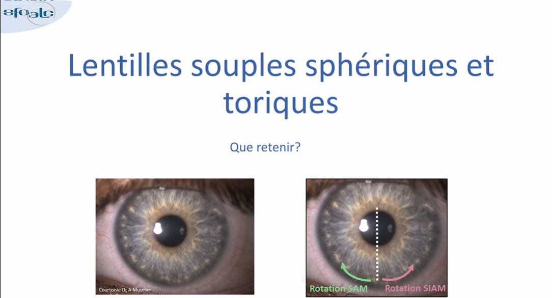 Wetlabs SFO_ Préclass Lentilles Souples_ Aurore Muselier