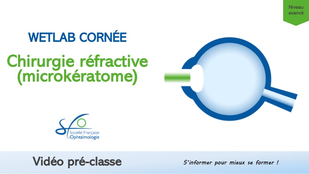 Chirurgie refractive microkeratome