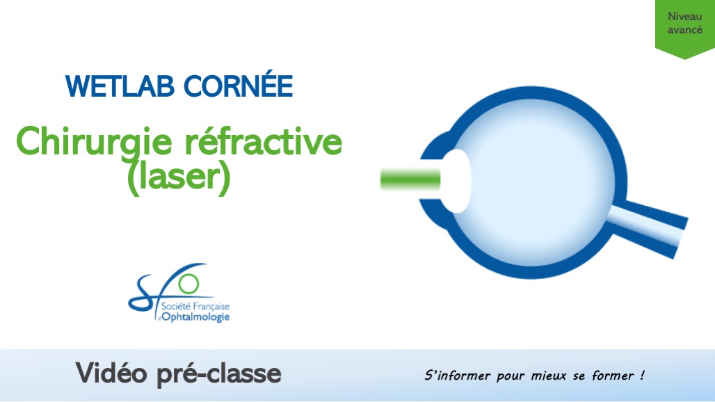 Chirurgie refractive Laser