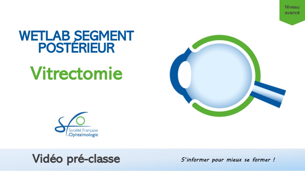 Cataracte et vitrectomie