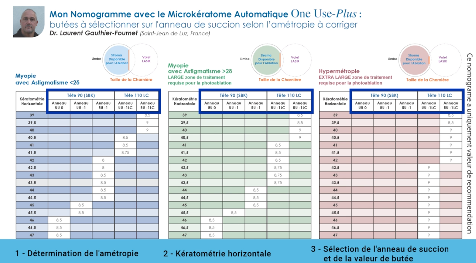Chirurgie Réfractive Microkeratome - Jean Marc Ancel