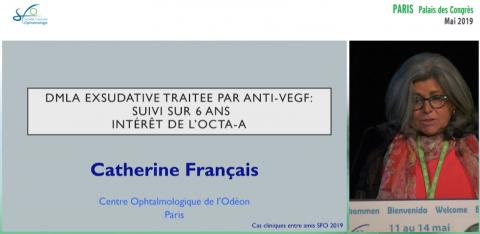 OCT ou OCT-A : décision de retraitement des NVC de la DMLA.