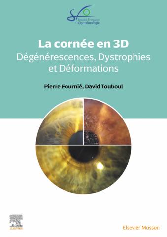 Dystrophies et dégénérescences cornéennes